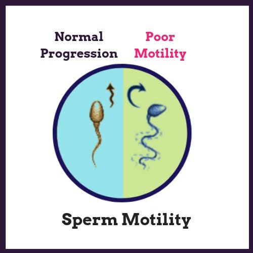 Sperm motility in fertile and infertile males